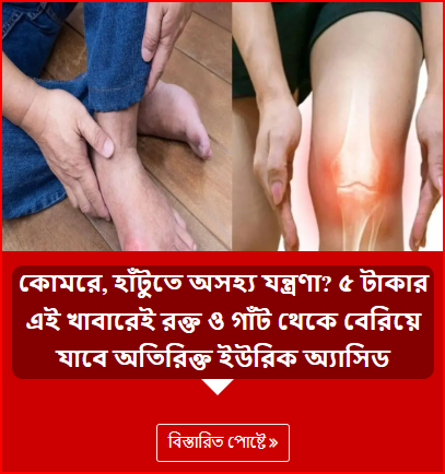 কোমরে, হাঁটুতে অসহ্য যন্ত্রণা? ৫ টাকার এই খাবারেই রক্ত ও গাঁট থেকে বেরিয়ে যাবে অতিরিক্ত ইউরিক অ্যাসিড