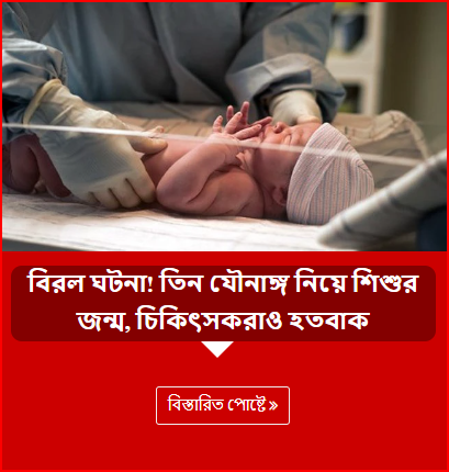 বিরল ঘটনা! তিন যৌনাঙ্গ নিয়ে শিশুর জন্ম, চিকিৎসকরাও হতবাক