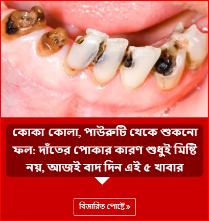 কোকা-কোলা, পাউরুটি থেকে শুকনো ফল: দাঁতের পোকার কারণ শুধুই মিষ্টি নয়, আজই বাদ দিন এই ৫ খাবার