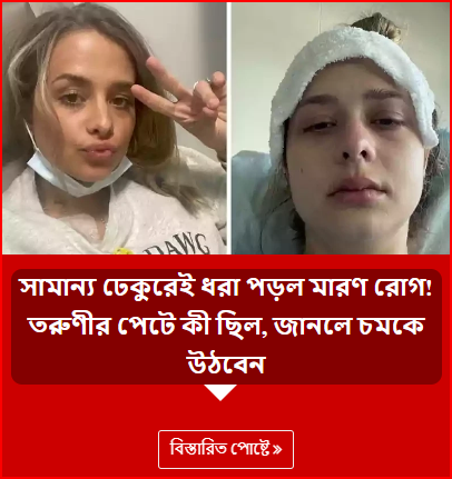 সামান্য ঢেকুরেই ধরা পড়ল মারণ রোগ! তরুণীর পেটে কী ছিল, জানলে চমকে উঠবেন